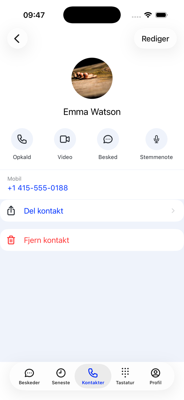 En kontakts profil med knapperne Ring op, Video, Besked og Talebesked, telefonnummeret, Del kontakt og Fjern kontakt