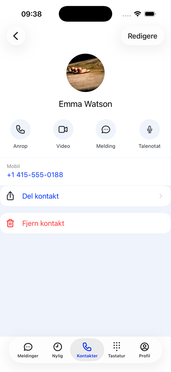 En kontakts profil med knappene Ring, Video, Melding og Talemelding, telefonnummeret, Del kontakt og Fjern kontakt