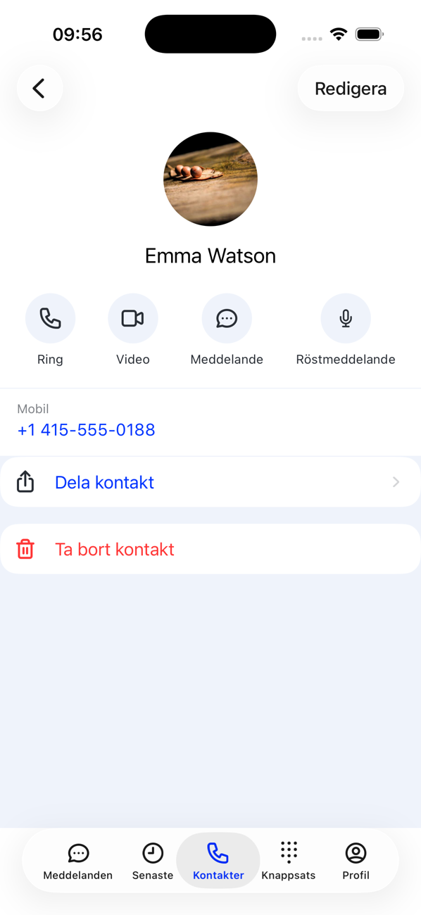 En kontakts profil med knapparna Ring, Video, Meddelande och Röstmeddelande, telefonnumret, Dela kontakt och Ta bort kontakt